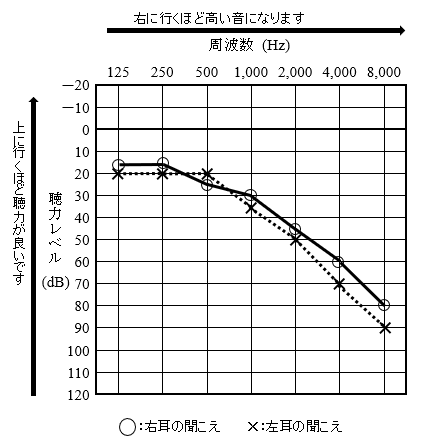 純音聴力検査の結果