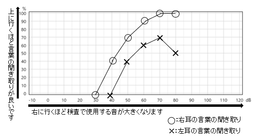 語音弁別検査の結果