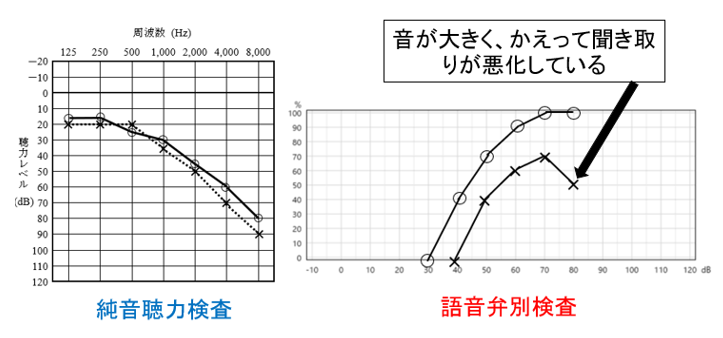 検査