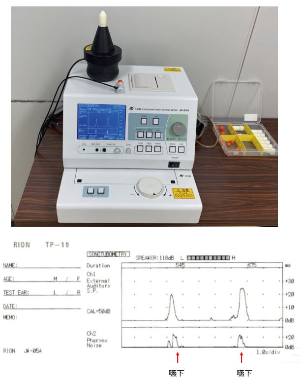 耳管機能検査