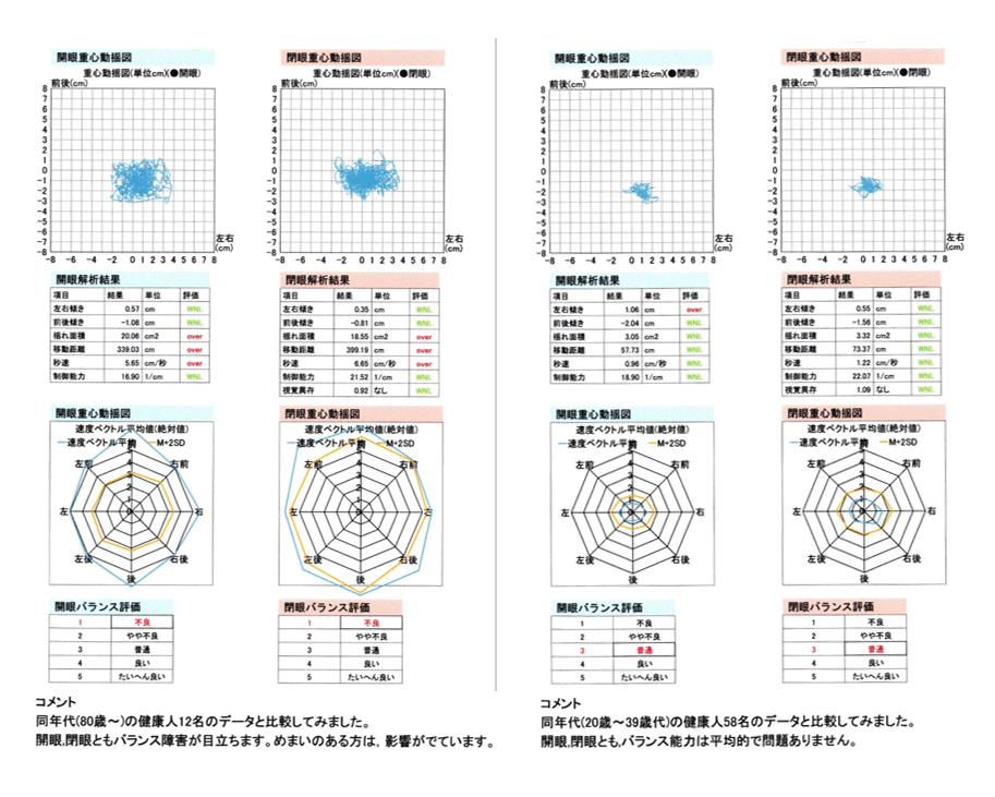 「重心動揺計」検査結果